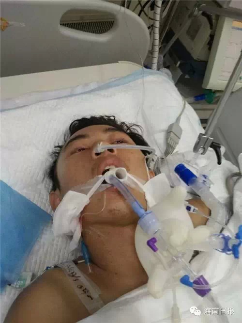 男生昏迷醒來(lái)失憶2年后返校重讀大三