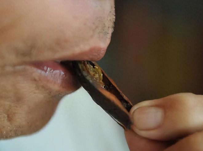 小伙嚼檳榔8年 瓜子臉變方塊臉