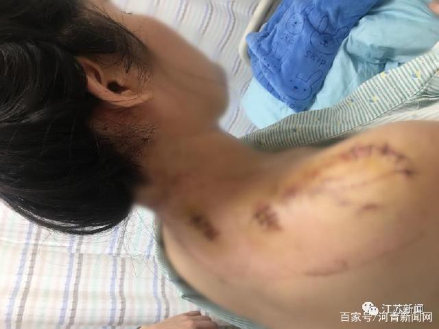 19歲小伙為保護女性遭鄰居捅傷
