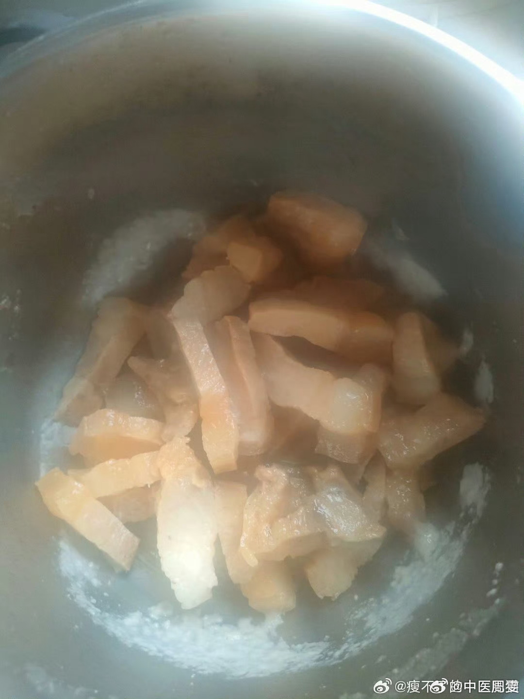 小伙喝飲料過多，雙手長滿痛風(fēng)石