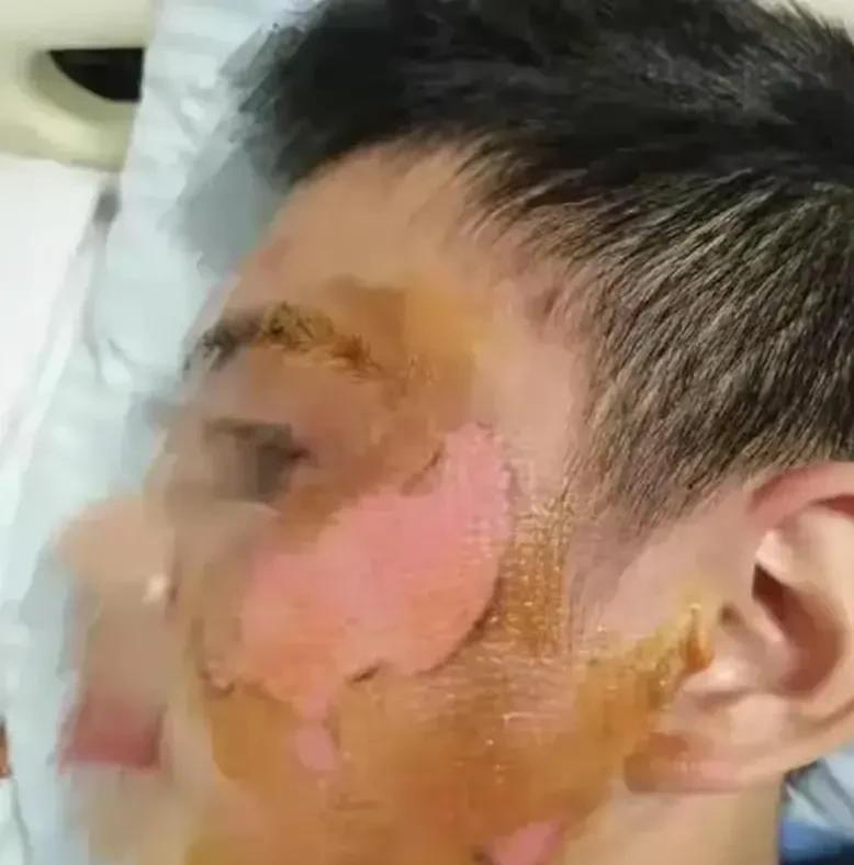 大四男生遭電瓶燒傷事件引起關(guān)注，室友被逮捕，大四男生燒傷事件調(diào)查，校園安全，大四男生被燒傷引發(fā)討論，警方介入，大四男生燒傷事件調(diào)查，意外事件，大四男生被燒傷引發(fā)關(guān)注