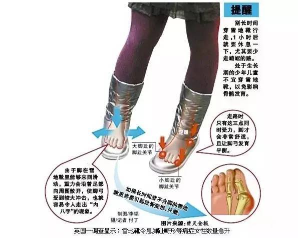 厚底雪地靴可能傷身，醫(yī)生緊急提醒