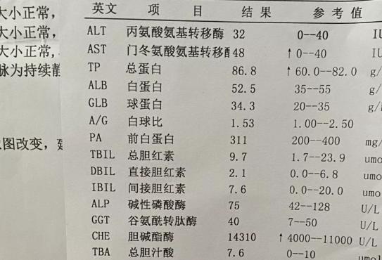 事業(yè)編體檢中轉(zhuǎn)氨酶標(biāo)準(zhǔn)詳解